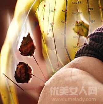 子宫出血症,针灸可有效缓解子宫出血症状